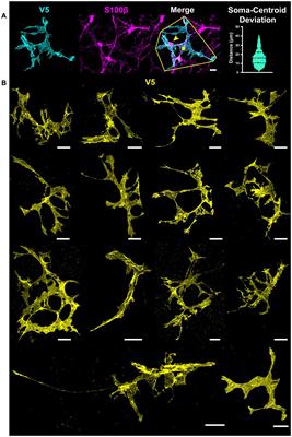 Retinal astrocyte morphology predicts integration of vascular and neuronal architecture